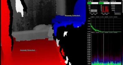 Xcam SLS Anomaly Detected